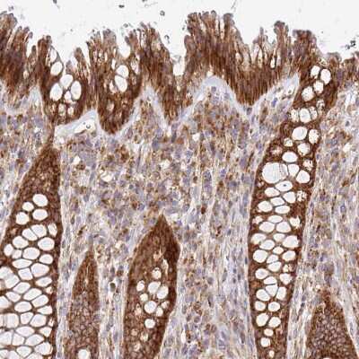 Immunohistochemistry-Paraffin: alpha-L-Iduronidase/IDUA Antibody [NBP2-49126]