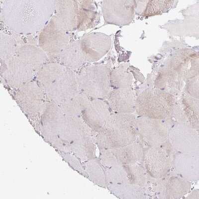 Immunohistochemistry-Paraffin: alpha-L-Iduronidase/IDUA Antibody [NBP2-49126]