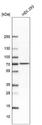 Western Blot: alpha-L-Iduronidase/IDUA Antibody [NBP2-48863]