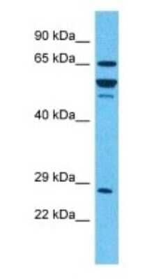 Western Blot: alpha-L-Iduronidase/IDUA Antibody [NBP3-10781]