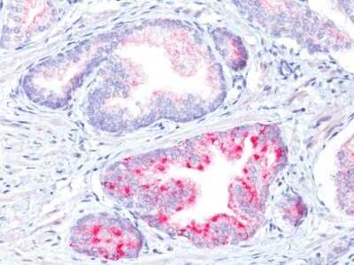 Immunohistochemistry-Paraffin: alpha-Methylacyl-CoA Racemase/AMACR Antibody - IHC-Prediluted [NBP2-48130]