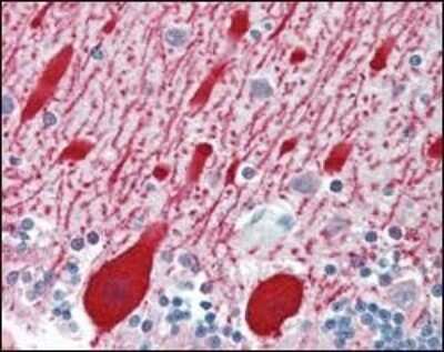 Immunohistochemistry-Paraffin: alpha-Methylacyl-CoA Racemase/AMACR Antibody (2A10F3) - BSA Free [NBP1-28884]
