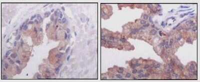 Immunohistochemistry-Paraffin: alpha-Methylacyl-CoA Racemase/AMACR Antibody (2A10F3) - BSA Free [NBP1-28884]