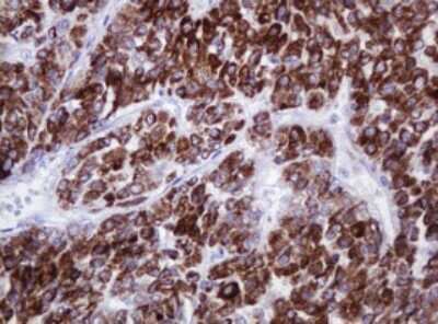 Immunohistochemistry: alpha-Methylacyl-CoA Racemase/AMACR Antibody (OTI5F10) [NBP2-45491]