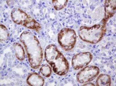 Immunohistochemistry: alpha-Methylacyl-CoA Racemase/AMACR Antibody (OTI5F10) [NBP2-45491]