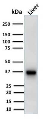 Western Blot: alpha-Methylacyl-CoA Racemase/AMACR Antibody (AMACR/1723)Azide and BSA Free [NBP2-54501]