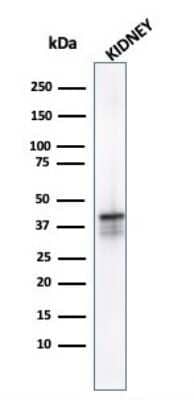 Western Blot: alpha-Methylacyl-CoA Racemase/AMACR Antibody (AMACR/1723)Azide and BSA Free [NBP2-54501]