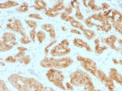 Immunohistochemistry-Paraffin: alpha-Methylacyl-CoA Racemase/AMACR Antibody (AMACR/1723) [NBP2-53390]