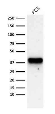 Western Blot: alpha-Methylacyl-CoA Racemase/AMACR Antibody (AMACR/1723) [NBP2-53390]
