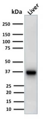 Western Blot: alpha-Methylacyl-CoA Racemase/AMACR Antibody (AMACR/1723) [NBP2-53390]