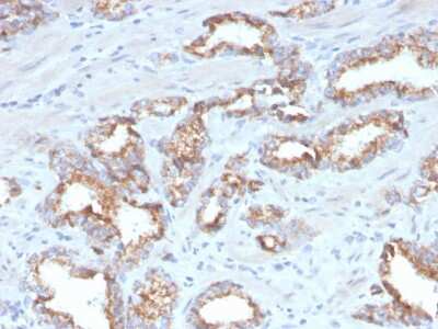 Immunohistochemistry-Paraffin: alpha-Methylacyl-CoA Racemase/AMACR Antibody (AMACR/4572R) - Azide and BSA Free [NBP3-08468]
