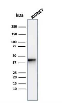 Western Blot: alpha-Methylacyl-CoA Racemase/AMACR Antibody (AMACR/4572R)Azide and BSA Free [NBP3-08468]