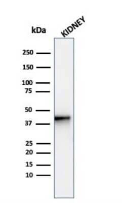 Western Blot: alpha-Methylacyl-CoA Racemase/AMACR Antibody (AMACR/4572R) [NBP3-07592]