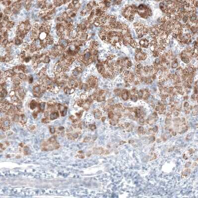 Immunohistochemistry-Paraffin: alpha-Methylacyl-CoA Racemase/AMACR Antibody (CL9360) [NBP2-88930]
