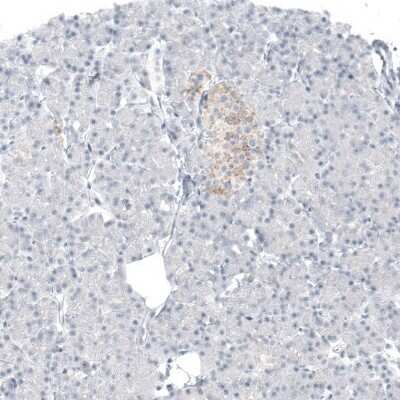 Immunohistochemistry-Paraffin: alpha-Methylacyl-CoA Racemase/AMACR Antibody (CL9360) [NBP2-88930]