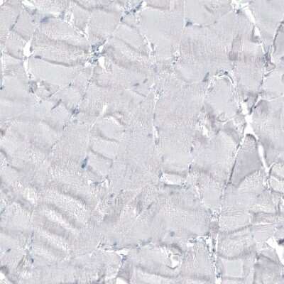 Immunohistochemistry-Paraffin: alpha-Methylacyl-CoA Racemase/AMACR Antibody (CL9360) [NBP2-88930]