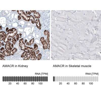 Immunohistochemistry-Paraffin: alpha-Methylacyl-CoA Racemase/AMACR Antibody (CL9360) [NBP2-88930]