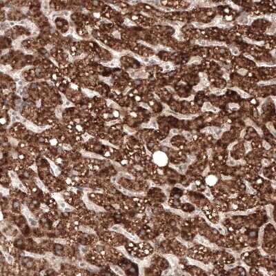 Immunohistochemistry-Paraffin: alpha-Methylacyl-CoA Racemase/AMACR Antibody (CL9362) [NBP2-88931]
