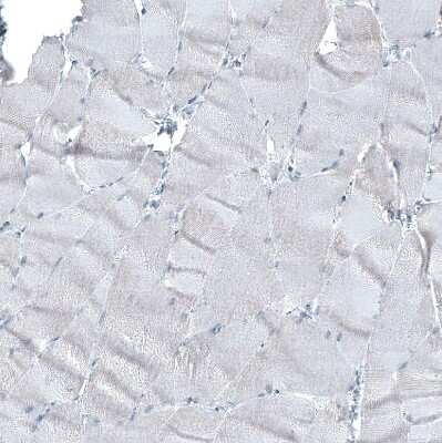 Immunohistochemistry-Paraffin: alpha-Methylacyl-CoA Racemase/AMACR Antibody (CL9362) [NBP2-88931]