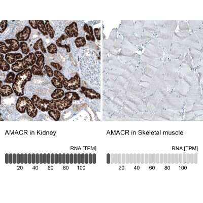 Immunohistochemistry-Paraffin: alpha-Methylacyl-CoA Racemase/AMACR Antibody (CL9362) [NBP2-88931]