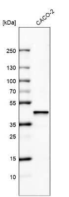 Western Blot: alpha-Methylacyl-CoA Racemase/AMACR Antibody (CL9362) [NBP2-88931]