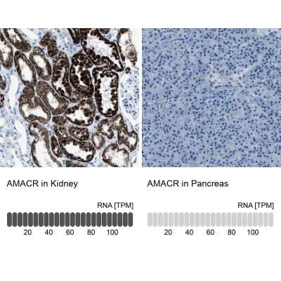 Immunohistochemistry-Paraffin: alpha-Methylacyl-CoA Racemase/AMACR Antibody [NBP1-87168]