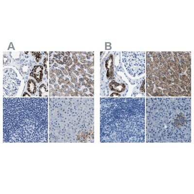 Immunohistochemistry-Paraffin: alpha-Methylacyl-CoA Racemase/AMACR Antibody [NBP1-87169]