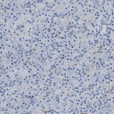 Immunohistochemistry-Paraffin: alpha-Methylacyl-CoA Racemase/AMACR Antibody [NBP1-87169]