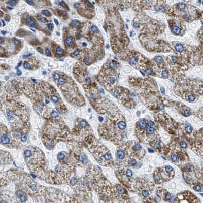 Immunohistochemistry-Paraffin: alpha-Methylacyl-CoA Racemase/AMACR Antibody [NBP1-87169]