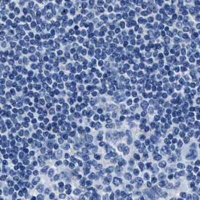 Immunohistochemistry-Paraffin: alpha-Methylacyl-CoA Racemase/AMACR Antibody [NBP1-87169]