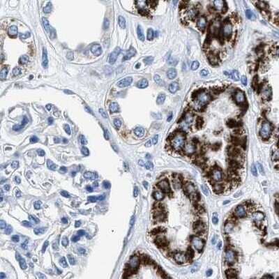 Immunohistochemistry-Paraffin: alpha-Methylacyl-CoA Racemase/AMACR Antibody [NBP1-87169]