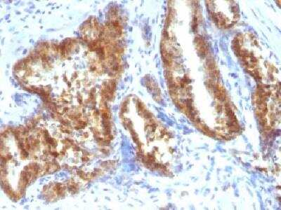 Immunohistochemistry-Paraffin: alpha-Methylacyl-CoA Racemase/AMACR Antibody [NBP2-32916]