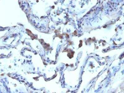 Immunohistochemistry-Paraffin: alpha-Methylacyl-CoA Racemase/AMACR Antibody [NBP2-32916]
