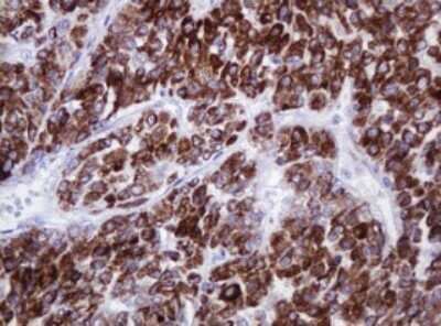 Immunohistochemistry: alpha-Methylacyl-CoA Racemase/AMACR Antibody (OTI5F10) - Azide and BSA Free [NBP2-71749]