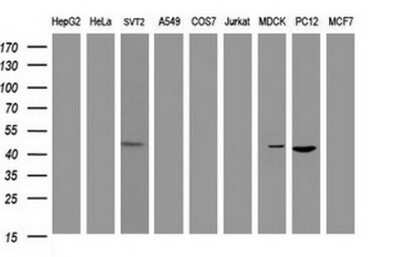 Western Blot: alpha-Methylacyl-CoA Racemase/AMACR Antibody (OTI5F10)Azide and BSA Free [NBP2-71749]