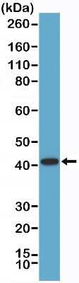 Western Blot: alpha-Methylacyl-CoA Racemase/AMACR Antibody (RM349) [NBP2-77417]