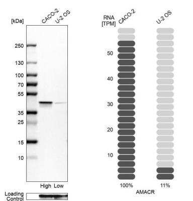 Western Blot: alpha-Methylacyl-CoA Racemase/AMACR Antibody [NBP1-87169]