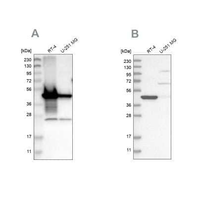 Western Blot: alpha-Methylacyl-CoA Racemase/AMACR Antibody [NBP1-87169]