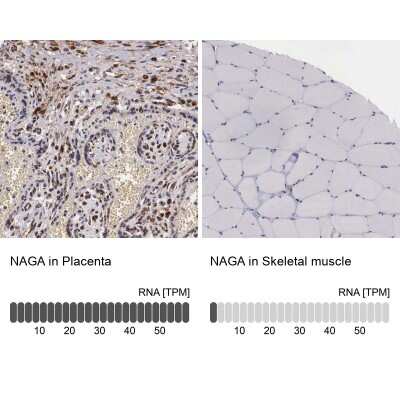 Immunohistochemistry-Paraffin: alpha-N-acetylgalactosaminidase/NAGA Antibody [NBP1-84318]