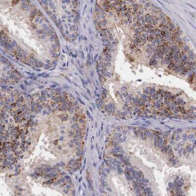 Immunohistochemistry-Paraffin: alpha-N-acetylgalactosaminidase/NAGA Antibody [NBP1-84318]