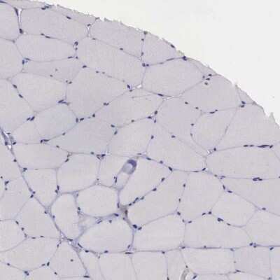 Immunohistochemistry-Paraffin: alpha-N-acetylgalactosaminidase/NAGA Antibody [NBP1-84318]