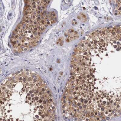 Immunohistochemistry-Paraffin: alpha-N-acetylgalactosaminidase/NAGA Antibody [NBP1-84318]