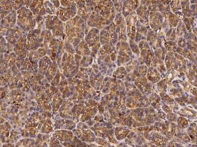 Immunohistochemistry-Paraffin: alpha-N-acetylgalactosaminidase/NAGA Antibody [NBP3-00180]