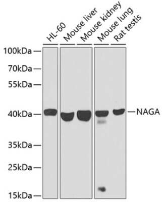 alpha-N-acetylgalactosaminidase/NAGA Antibody - BSA Free (NBP2-92593 ...