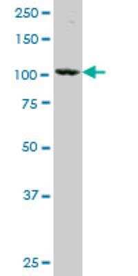 Western Blot: alpha-N-acetylglucosaminidase/NAGLU Antibody (1B7) [H00004669-M02]