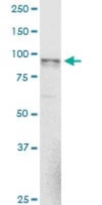 Western Blot: alpha-N-acetylglucosaminidase/NAGLU Antibody (1B7) [H00004669-M02]