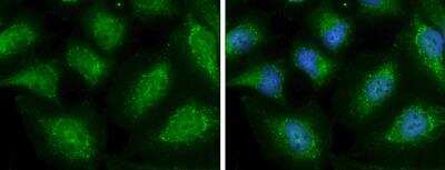Immunocytochemistry/ Immunofluorescence: alpha-N-acetylglucosaminidase/NAGLU Antibody [NBP1-31555]