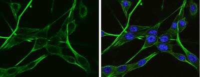 Immunocytochemistry/ Immunofluorescence: alpha-N-acetylglucosaminidase/NAGLU Antibody [NBP1-31555]