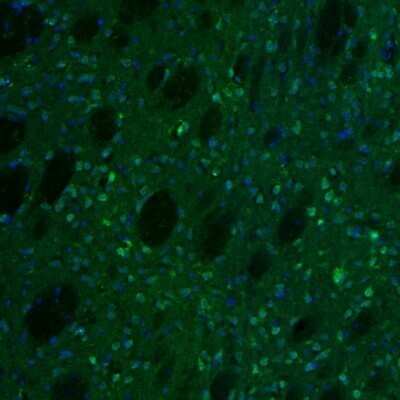 Immunohistochemistry: alpha-N-acetylglucosaminidase/NAGLU Antibody [NBP1-82601]