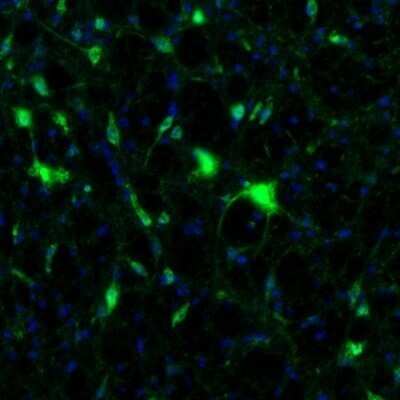 Immunohistochemistry: alpha-N-acetylglucosaminidase/NAGLU Antibody [NBP1-82601]